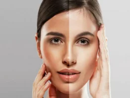چگونه پوستی شفاف و سفید داشته باشیم؟